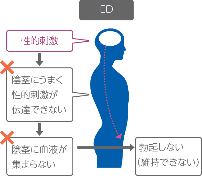 ED回復に有効なトレーニング7選！勃起力を高める方法やその効果を徹底解説 | 大阪梅田のメンズ美容・ED・AGAクリニック W