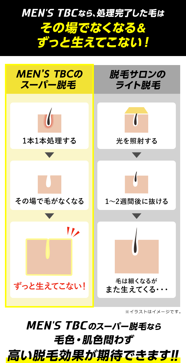 効果満足度98.0％※2「MEN'S TBCスーパー脱毛」 ヒゲ脱毛終了から12年後を公開！ | TBCグループ株式会社のプレスリリース