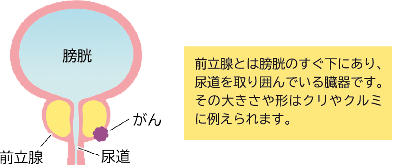 色:クリアブルー_サイズ:3L_スタイル:丸型】リス 即席漬物容器 丸型 クリの通販 by