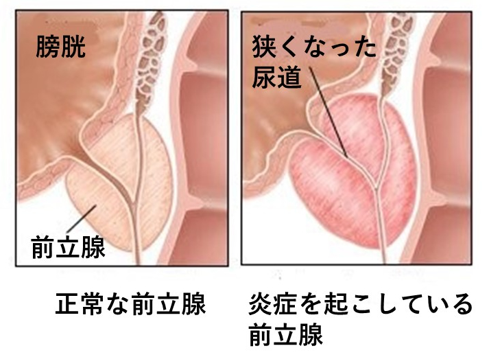 静岡県静岡市、駅近、市役所前、前立腺に効果、ヒップアップ、妊活にもオススメ、冷えむくみに効果ある『仙骨ケア』始めました！仙人の骨と書いて仙骨！！神秘的な骨であり体の真ん中にある身体を支えてるとても大事な骨です  | B＆I