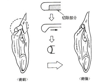 栗（クリ） | 山と公園（市街地）の植物図鑑