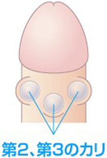 BijyutsuPENIS in KUNSTARZT