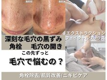 東金市でメンズ脱毛が人気のエステサロン｜ホットペッパービューティー