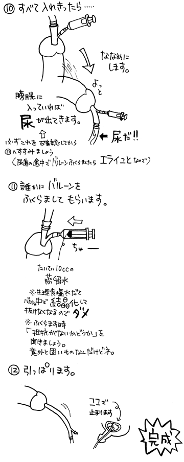 8mm/1個 ペニスプラグ ペニス中空 男性用 コックプラグ