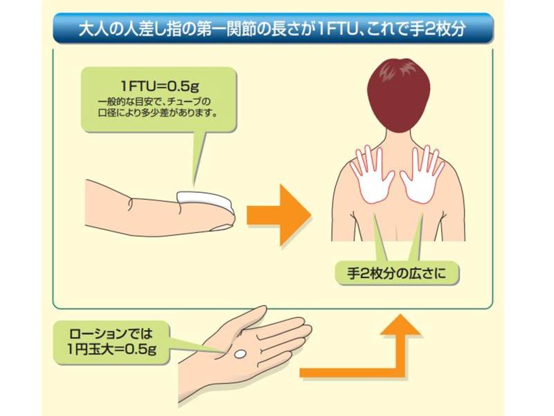 4. アトピー性皮膚炎の症状