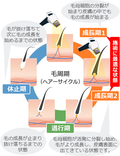 VIO脱毛の5つのメリットと3つのデメリットを紹介 - トイトイトイクリニック