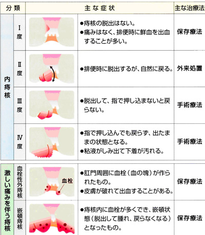 向ヶ丘胃腸・肛門クリニック｜向ヶ丘遊園・登戸の消化器内科・肛門外科