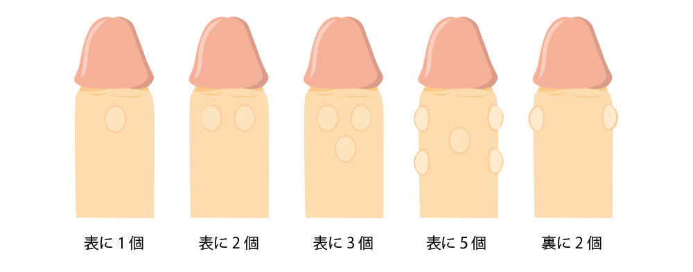 真珠サック 「パールコンバイン」 ｜ コックリング・ペニスサック