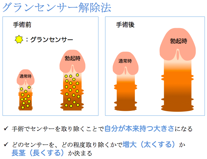 勃起を監視するコンドーム型デバイス ペニスの長さと円周を測定、遠隔医療に活用：Innovative Tech（2/2 ページ） -