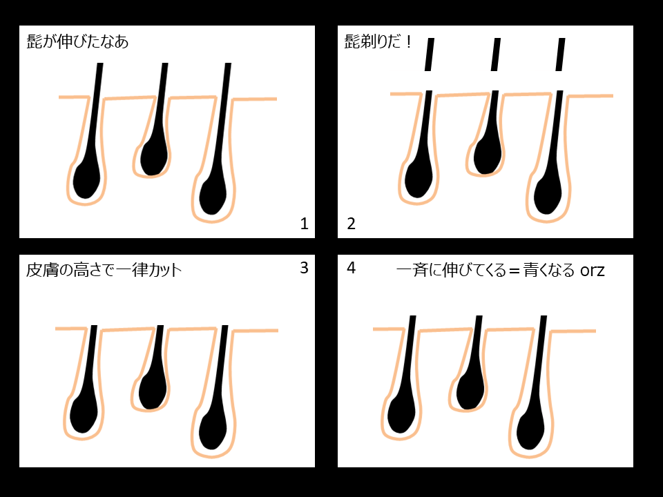 ヒゲ | 男のエステ ダンディハウス