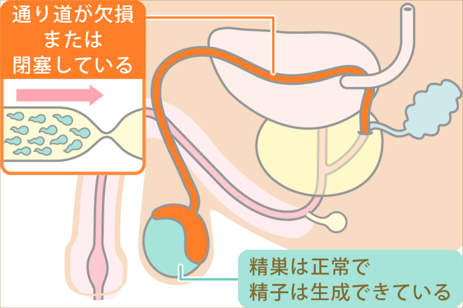 画像 | ｢日本人男性の精子｣量も質もよくない衝撃事実