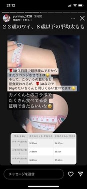 整形800万円アイドル・ゆりあんぬ 豊胸でe→fカップにバスト - ゆり