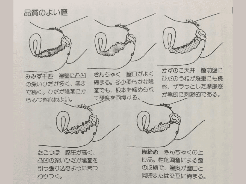 名器誕生】女性器整形の施術に密着してみた。 - YouTube