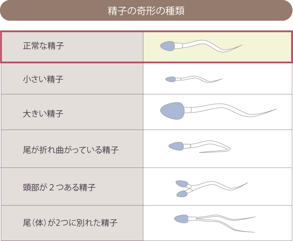 セックスにおすすめなのは朝か昼｣話題の奇書『射精道』を書いた不妊治療の専門医が断言するワケ 70年前､新婚カップルのセックス回数は週平均3.9回だった 