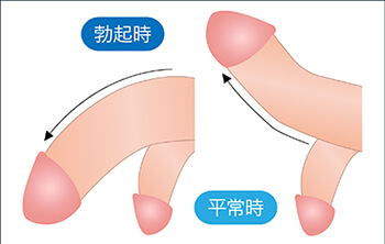 女性に好かれる上反りペニスとは？上向きペニスとの違いやトレーニング方法など | ザヘルプM