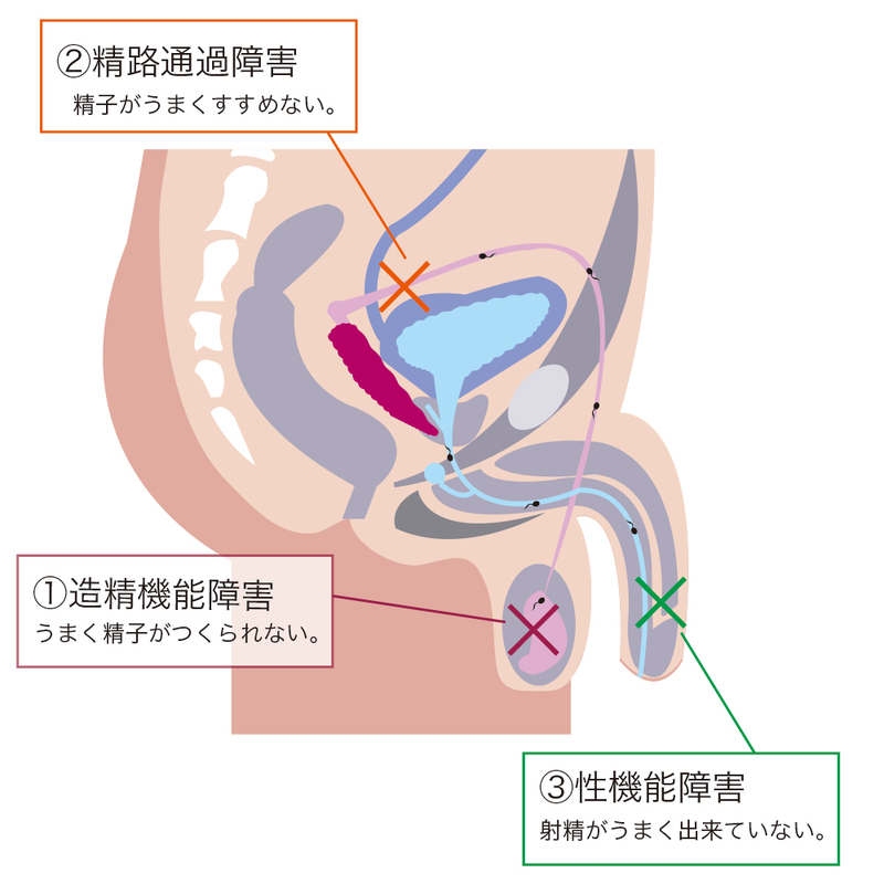 まずいウニの原因はミョウバン？美味しいウニとまずいウニは何が違うの？ - 魚河岸ウォーカー