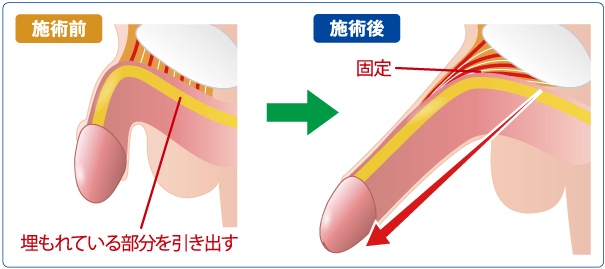 コックリング特集 着けるだけのカンタン増強！｜大人のおもちゃとアダルトグッズの通販ショップNLS