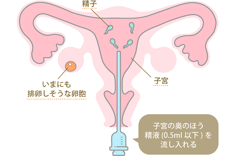 保健体育で習ったことと全然違う…不妊治療の専門医が教える｢排卵するたった1つの卵子はどう選ばれるか｣  約10個の中から1つに絞られる基準は質ではなく大きさ (2ページ目) |