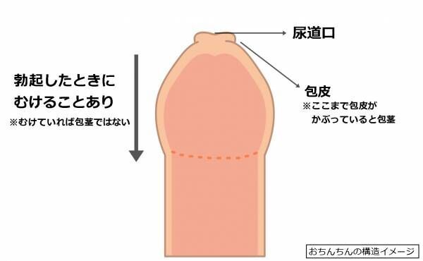 むけない包茎を自分で改善できる方法「むきトレ」とは？ | ネオ形成外科