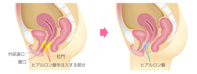 今さら聞けない女性器の構造について。上付き下付きを知る方法