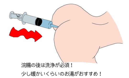 一番正しいアナルファックのやり方！初心者でもお尻を楽しめるAF解説｜駅ちか！風俗雑記帳