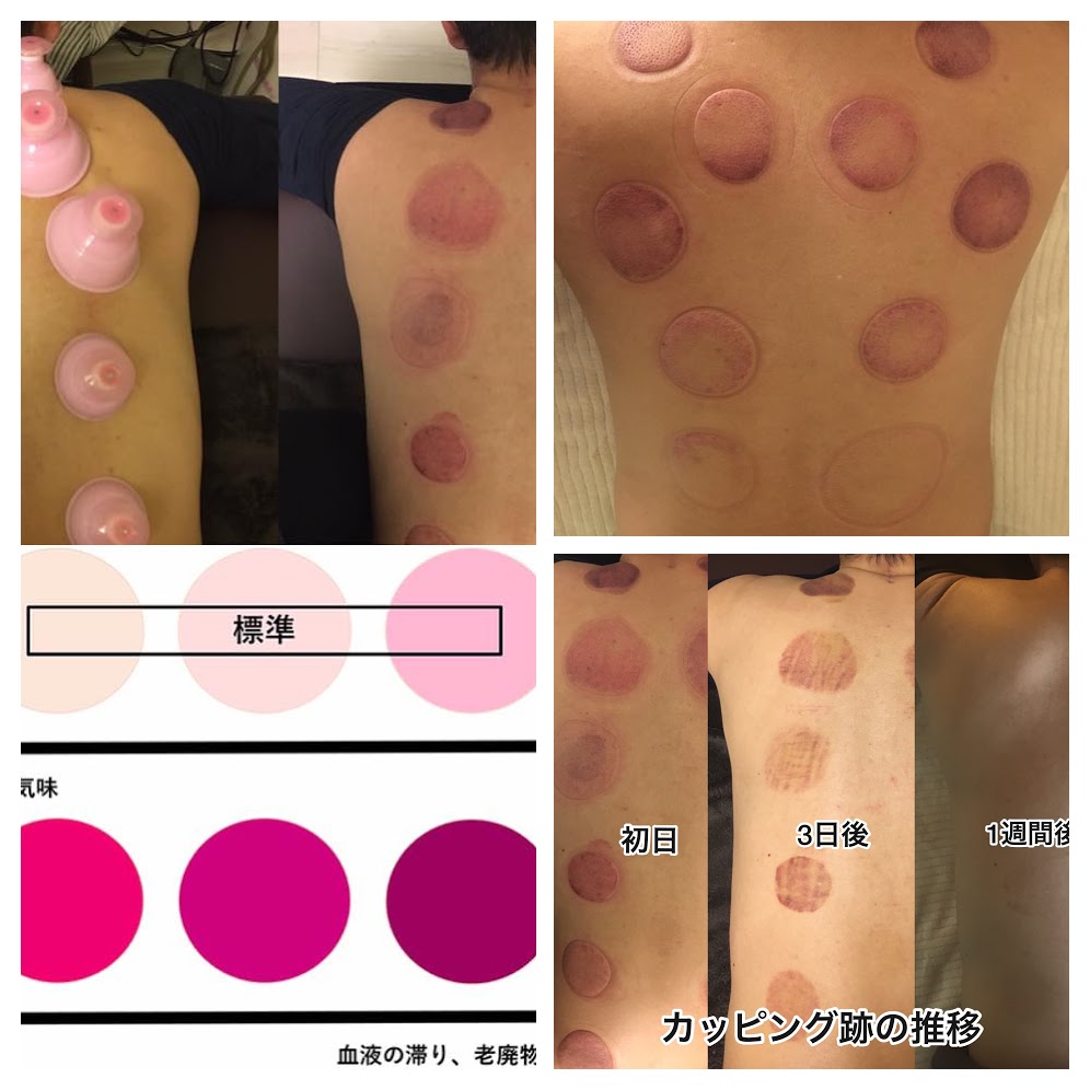 Yuki✨チネイザンでお腹痩せを叶える✨たまよろ庵®︎ | 「チネイザンセラピスト」