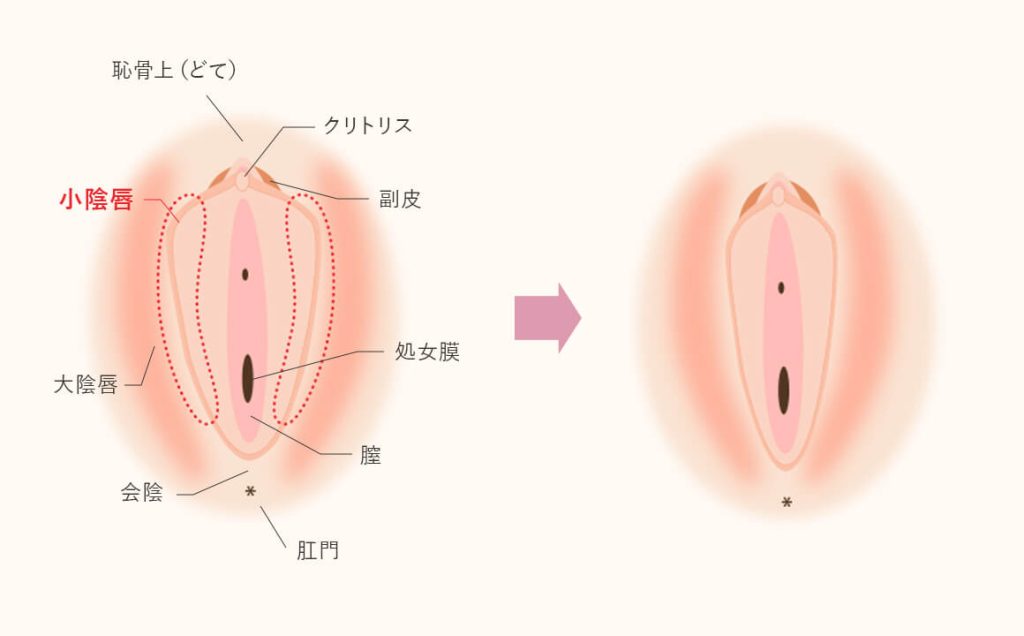 上付きマ○コと下付きマ○コ