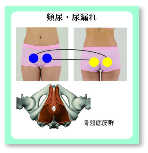 楽天市場】骨盤底筋 トレーニング emsの通販