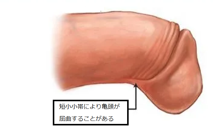 短小ちんこの基準は7cm！租チンの原因や改善する方法もまとめ