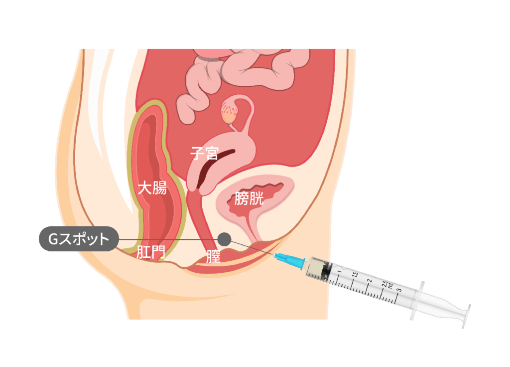 前立腺マッサージとはどんなプレイ？ 風俗エステ嬢がやり方を詳細解説 |