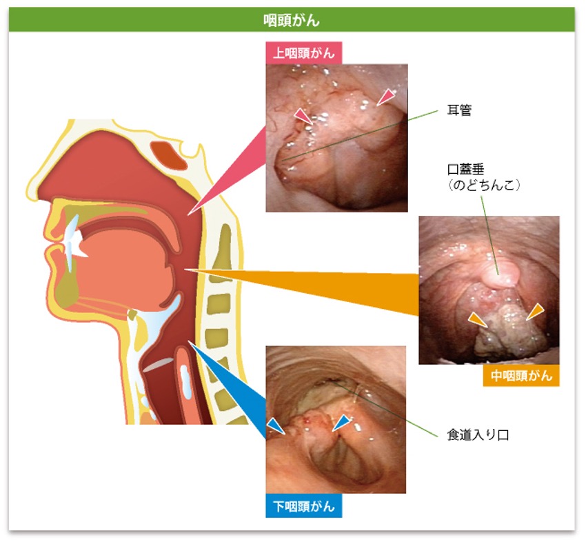 クラミジアの解説 症状や感染経路・検査や治療について│STD研究所