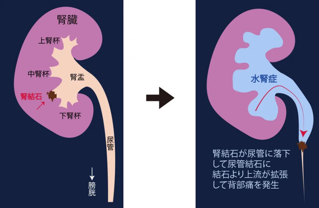 健康診断の前日はオナニー禁止？尿検査の項目や対策などを解説｜風じゃマガジン