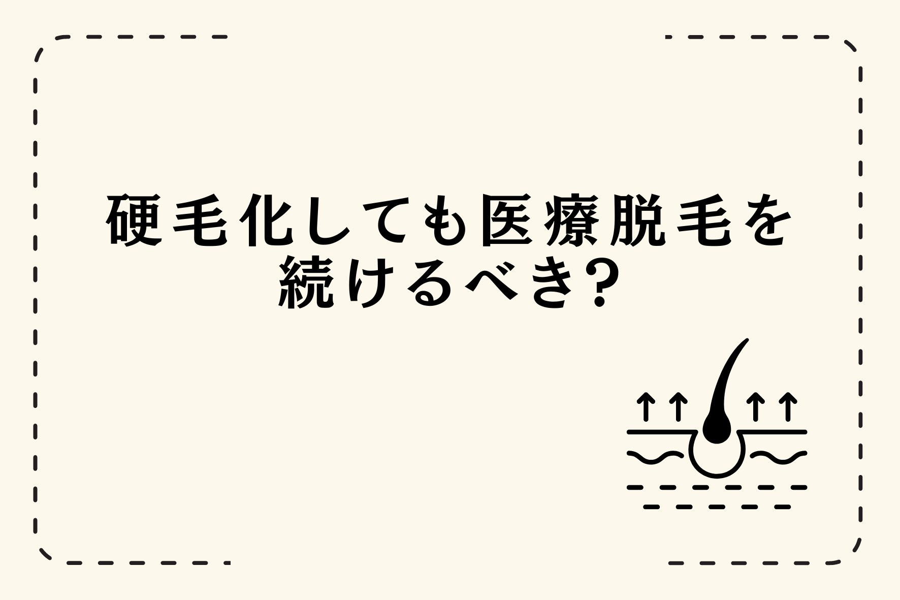 脱毛のメリット・デメリットは？初めて脱毛をする方におすすめの方法を紹介 | 脱毛コラム｜【STLASSH公式】