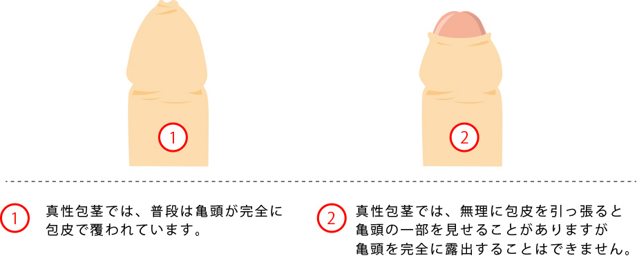 ちんこの皮の剥き方が知りたいです。 | セイシル