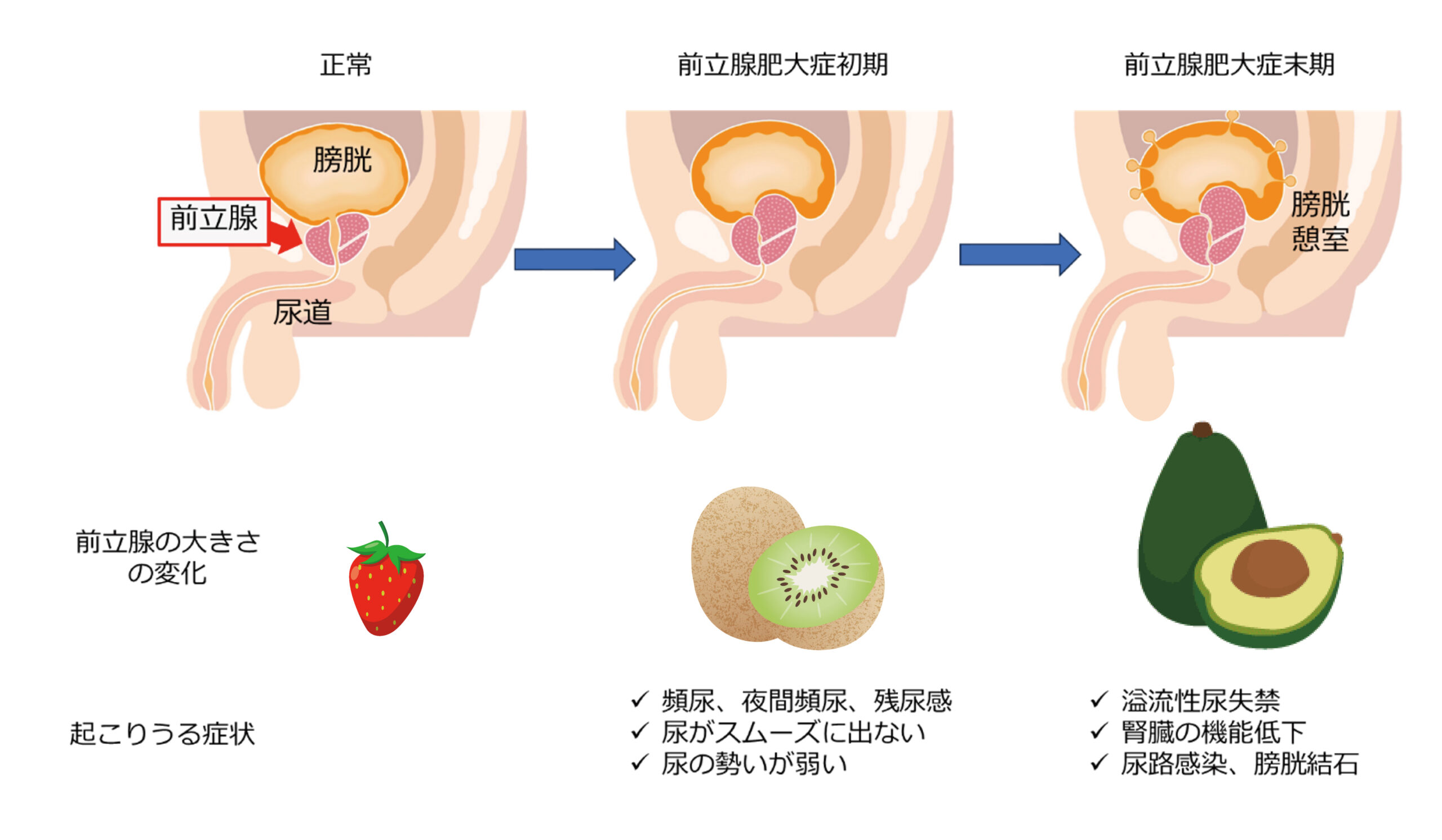 エネマグラとは？使い方とドライオーガズム - 夜の保健室