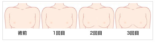 渋谷の多汗症ボトックス注射のおすすめクリニック｜美容医療の口コミ広場