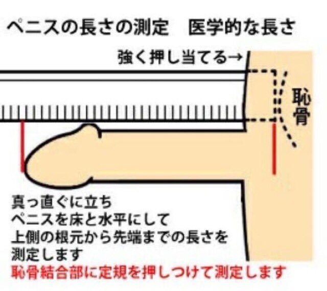 ペニスの大きさは平均どれくらい？日本人のペニスサイズや測り方、小さい原因を解説 | 包茎手術のノーストクリニック【公式】