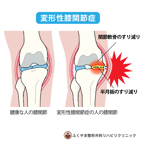 医療脱毛 ｜ 鹿児島の美容皮膚科・美容外科｜アトールクリニック