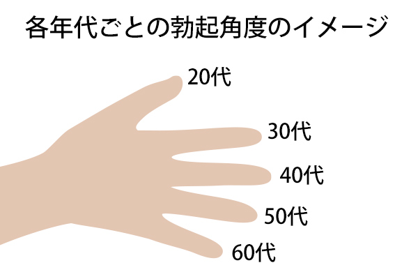 性欲と無関係に起こる持続勃起症緊急治療要することも（東邦大学医療センター大森病院リプロダクションセンター 永尾光一センター長）｜医療ニュース  トピックス｜時事メディカル｜時事通信の医療ニュースサイト