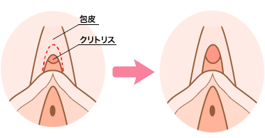 クリトリス包茎だと感じづらい？皮の剥き方 - 夜の保健室