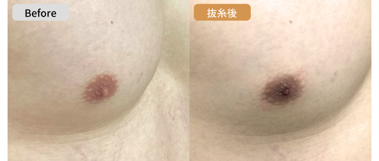 乳首と乳首の間が超敏感」な男性が上半身裸で拘束された結果…感動的な結末が待っていた!? | ABCマガジン