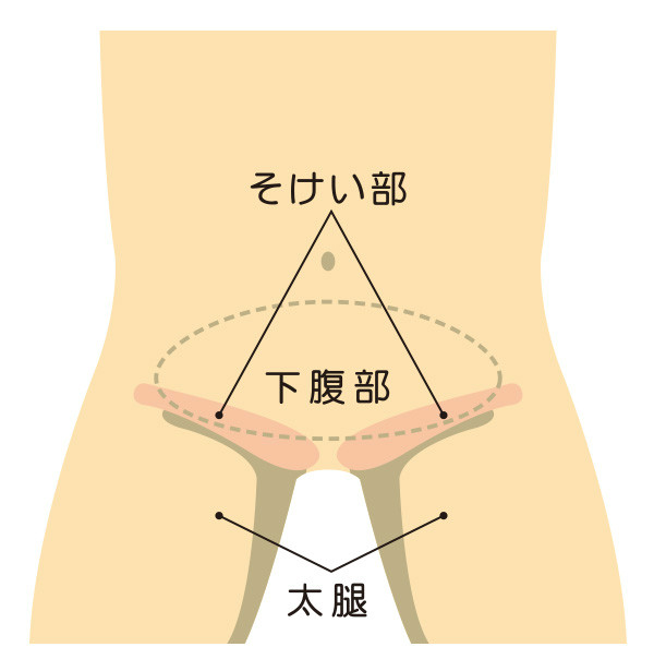 鼠径部（そけいぶ）とは？場所や起こる病気をわかりやすく解説！｜ブログ｜Gi外科クリニック