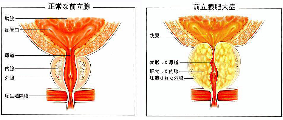 前立腺マッサージからはじまるドライオーガズム―不快感こそ第一歩 | ドライオーガズム研究部