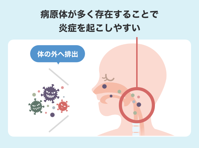 扁桃炎と性病の見分け方とは？咽頭（のど）に感染する？