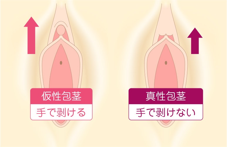 まるごと陰核（クリトリス）|アダルトグッズや大人のおもちゃ、玩具の通販ショップのNLS