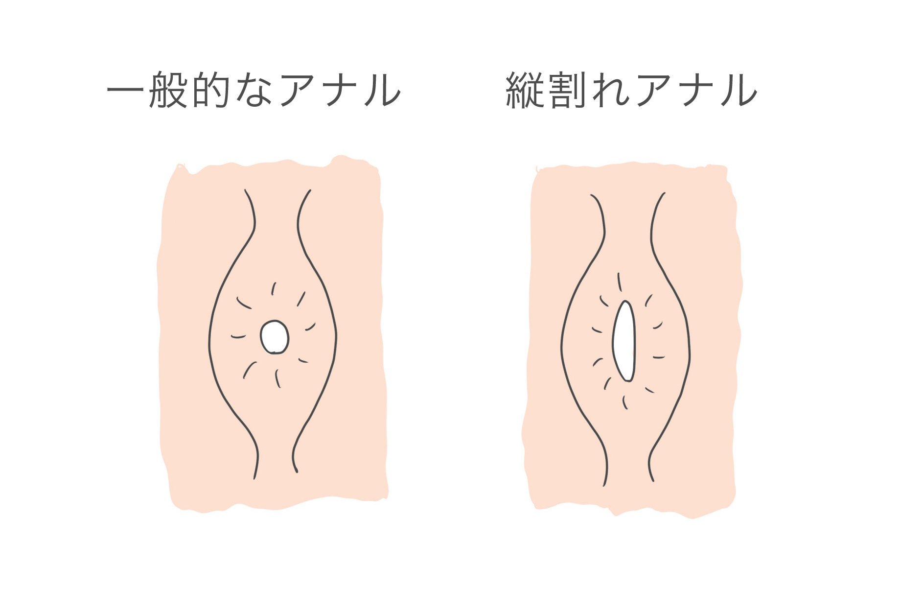 大腸がん - 性病検査キットを使って自宅で簡単検査 GME医学検査研究所