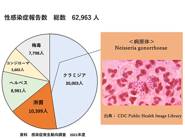 のどの痛みの症状・原因｜くすりと健康の情報局