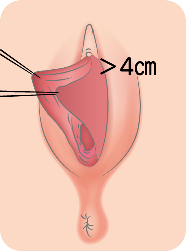 ペニスのサイズ（短小・巨根）について とある女性の意見 -