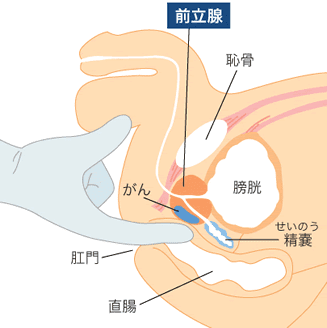 前立腺マッサージって？やり方や効果から受けられる五反田の風俗まで解説！｜五反田のＭ性感お役立ち情報