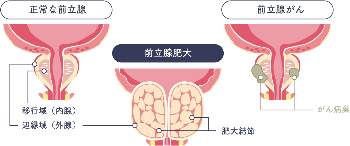 男性必見！健康的な身体を手に入れるツボ推し